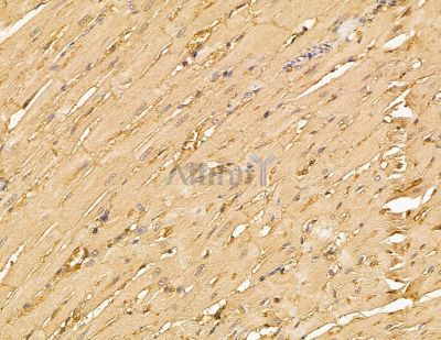UBE2A/B Antibody - DF9999 at 1/100 staining rat heart tissue by IHC-P.