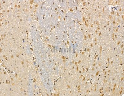 UBE2A/B Antibody - DF9999 at 1/100 staining rat brain tissue by IHC-P.