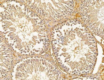 UBE2A/B Antibody - DF9999 at 1/100 staining rat testis tissue by IHC-P.