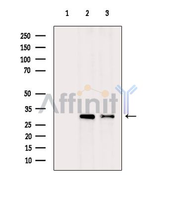 CDK20 Antibody - Western blot analysis of extracts from various samples, using CDK20 Antibody.