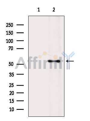 KCNA1 Antibody - Western blot analysis of extracts from Rat heart, using KCNA1 Antibody.