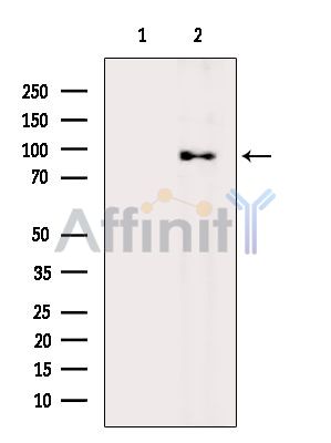 IGF1 Receptor Antibody - Western blot analysis of extracts from MCF7 cells(H2O2 treatment), using IGF1 Receptor Antibody.