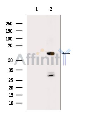 PKM2 Antibody - Western blot analysis of extracts from MCF7 cells(H2O2 treatment), using PKM2 Antibody.