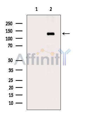 JAK1 Antibody - Western blot analysis of extracts from P19 cells(UV treatment), using JAK1 Antibody.