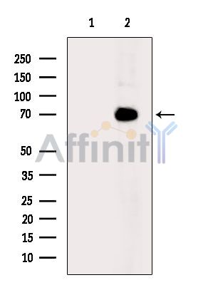 DNAJC2/MPP11 Antibody - Western blot analysis of extracts from MCF7 cells(heat-shock treatment), using DNAJC2/MPP11 Antibody.