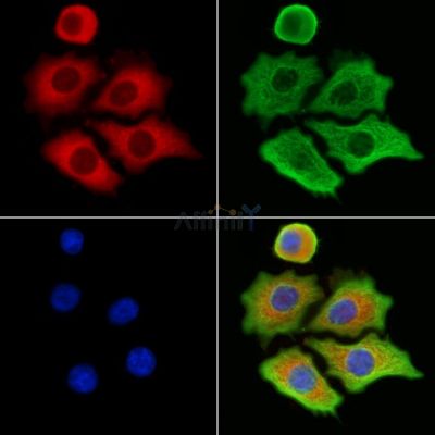 MTHFD1L Antibody - DF12425 staining HepG2 cells by IF/ICC.