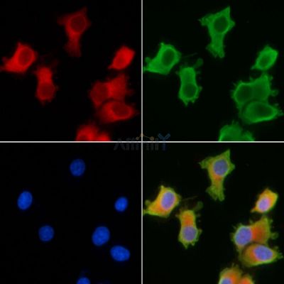NPLOC4 Antibody - DF13194 staining HepG2 cells by IF/ICC.
