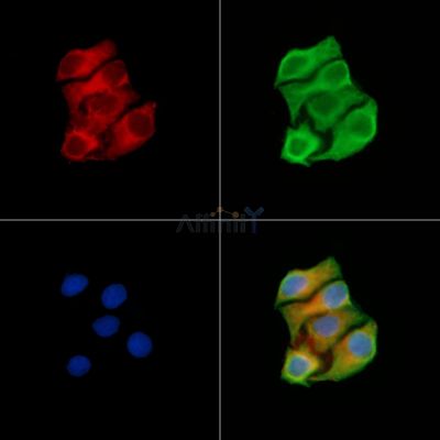 Methylmalonyl Coenzyme A mutase Antibody - DF13718 staining Hela cells by IF/ICC.