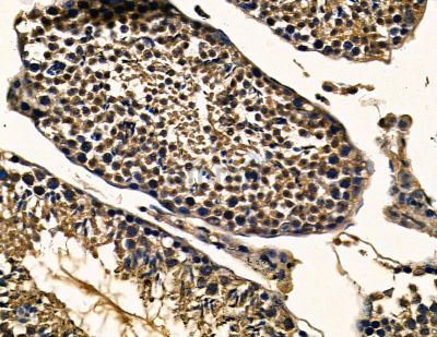 CTR9 Antibody - DF13764 at 1/100 staining mouse testis tissue by IHC-P.