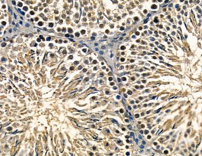 CTR9 Antibody - DF13764 at 1/100 staining rat testis tissue by IHC-P.