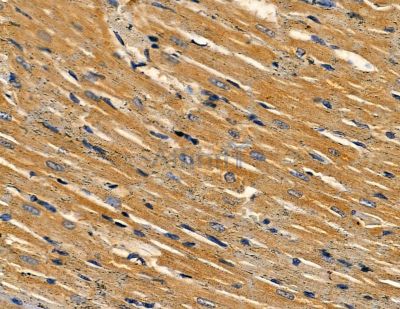 VDAC3 Antibody - DF13768 at 1/100 staining rat heart tissue by IHC-P.