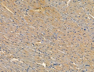 FBXO38 Antibody - DF13772 at 1/100 staining rat heart tissue by IHC-P.