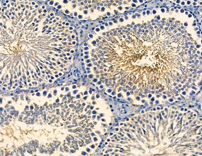 FBXO38 Antibody - DF13772 at 1/100 staining rat testis tissue by IHC-P.