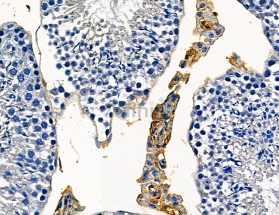 TRIAD3 Antibody - DF13775 at 1/100 staining mouse testis tissue by IHC-P.