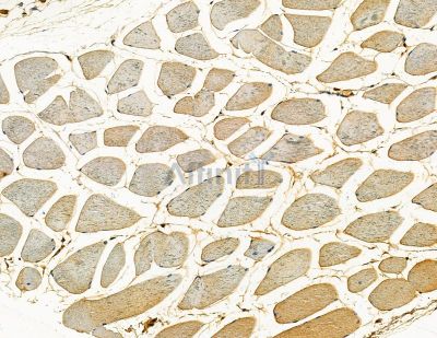 TRIAD3 Antibody - DF13775 at 1/100 staining mouse muscle tissue by IHC-P.