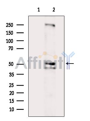 ONECUT2 Antibody - Western blot analysis of extracts from MCF7 cells(serum starvation treatment), using ONECUT2 Antibody.