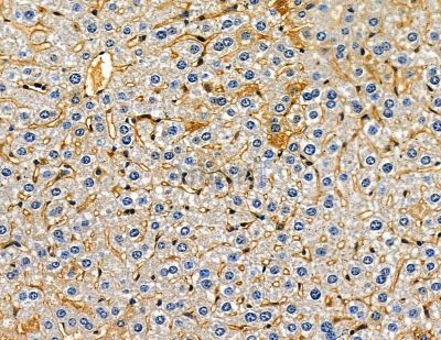 ONECUT2 Antibody - DF13779 at 1/100 staining mouse liver tissue by IHC-P.