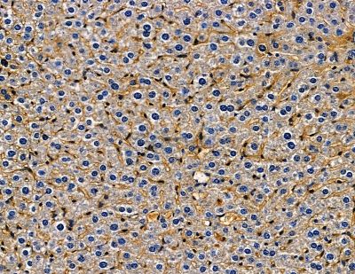 ADAMTS15 Antibody - DF13780 at 1/100 staining mouse skin tissue by IHC-P.