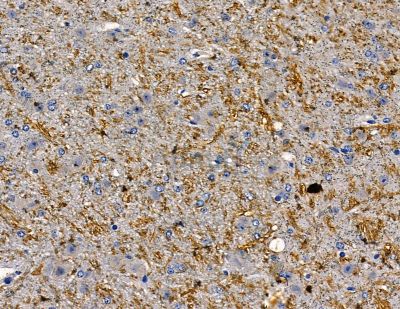 KCNH5 Antibody - DF13785 at 1/100 staining mouse brain tissue by IHC-P.