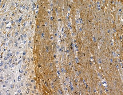 KCNH5 Antibody - DF13785 at 1/100 staining rat brain tissue by IHC-P.