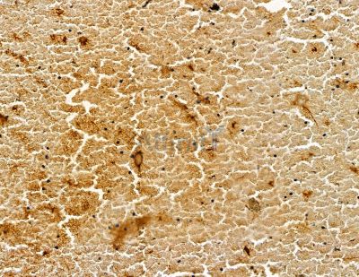 SCN3B Antibody - DF13794 at 1/100 staining mouse heart tissue by IHC-P.