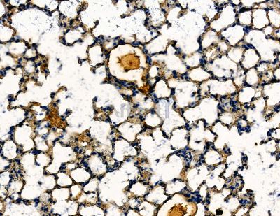 BRN3B/POU4F2 Antibody - DF13801 at 1/100 staining mouse lung tissue by IHC-P.