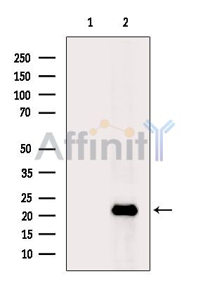 BTF3 Antibody - Western blot analysis of extracts from MCF7 cells(serum starvation treatment), using BTF3 Antibody.