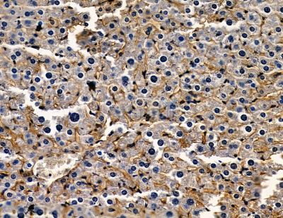 MKRN1 Antibody - DF13815 at 1/100 staining mouse liver tissue by IHC-P.