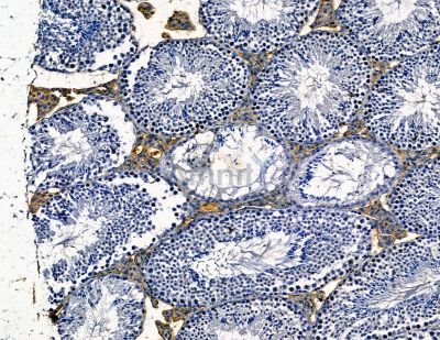 MKRN1 Antibody - DF13815 at 1/100 staining mouse testis tissue by IHC-P.