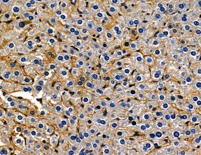 Sprouty 1 Antibody - DF13819 at 1/100 staining mouse liver tissue by IHC-P.