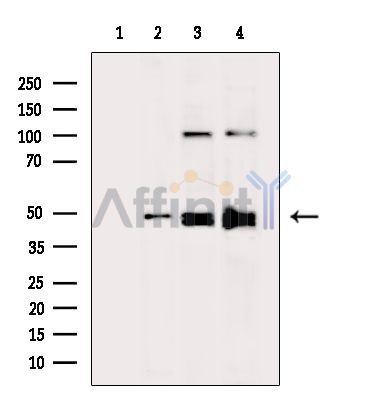 Argininosuccinate Lyase Antibody - Western blot analysis of extracts from various samples, using Argininosuccinate Lyase Antibody.