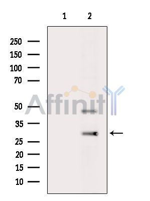 NAA60 Antibody - Western blot analysis of extracts from MC-3T3-E1 cells(H2O2 treatment), using NAA60 Antibody.