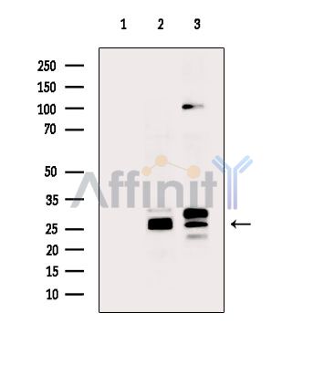 EFHD2 Antibody - Western blot analysis of extracts from various samples, using EFHD2 Antibody.