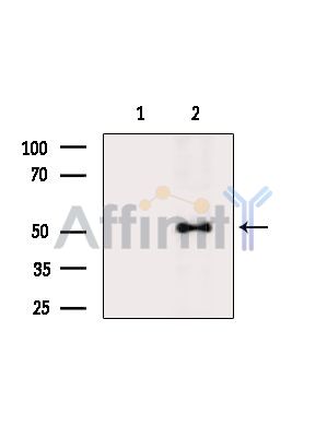 TRIM72 Antibody - Western blot analysis of extracts from Rat liver, using TRIM72 Antibody.