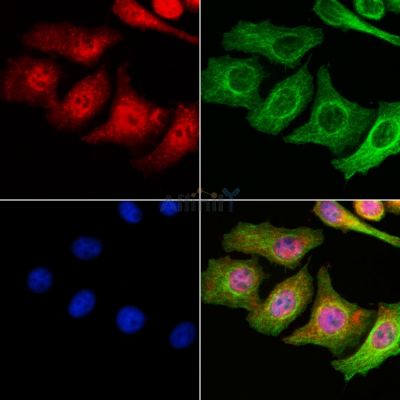 TFAP2D Antibody - DF2421 staining Hela cells by IF/ICC.