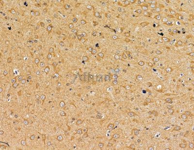 IFNA4/10/14 Antibody - DF2515 at 1/100 staining rat brain tissue by IHC-P.