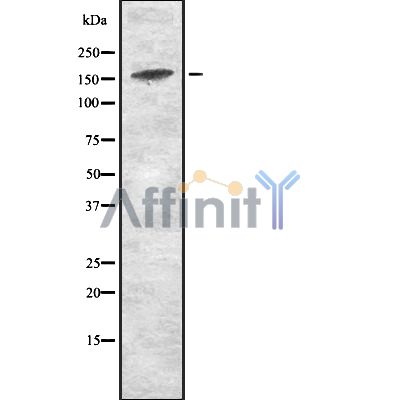 JAD1D Antibody - Western blot analysis of JAD1D expression in HEK293 cells.