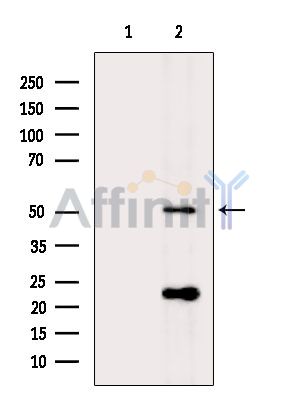 PIK3R3 Antibody - Western blot analysis of extracts from P19 cells(H2O2 treatment), using PIK3R3 Antibody.