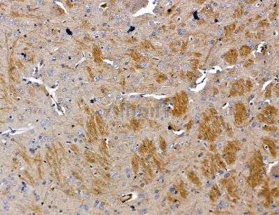 PIK3R3 Antibody - DF2629 at 1/100 staining rat brain tissue by IHC-P.