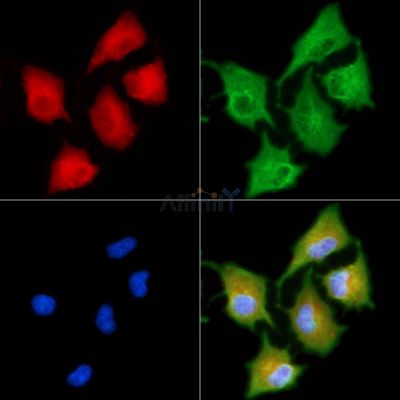 GPR22 Antibody - DF2732 staining A549 cells by IF/ICC.