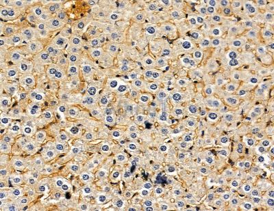 PJCG2 Antibody - DF2859 at 1/100 staining mouse liver tissue by IHC-P.