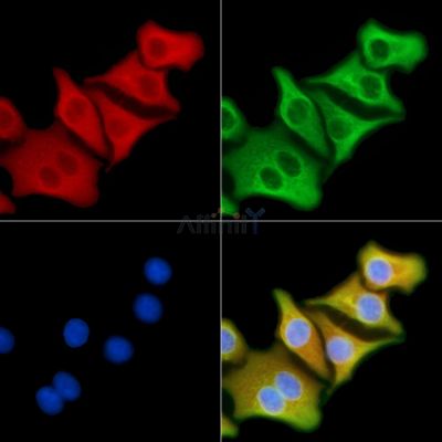 M-CK Antibody - DF3072 staining Hela cells by IF/ICC.