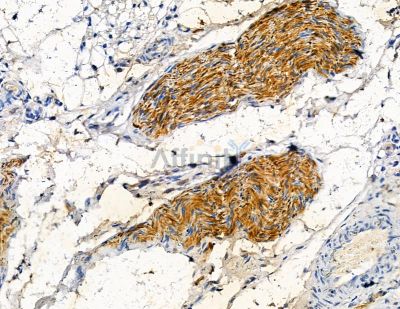 Collagen XX  alpha 1 Antibody - DF3555 at 1/100 staining rat lung tissue by IHC-P.