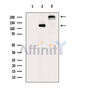 Collagen XX  alpha 1 Antibody - Western blot analysis of extracts from various samples, using Collagen XX  alpha 1 Antibody.