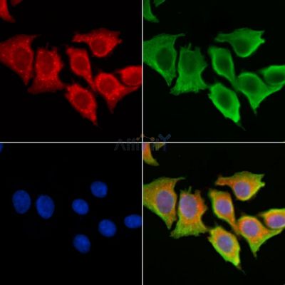 CLN6 Antibody - DF3928 staining HepG2 cells by IF/ICC.