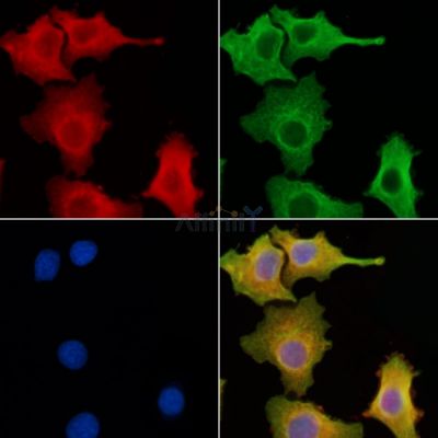 CLCC1 Antibody - DF3930 staining Hela cells by IF/ICC.