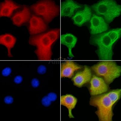 CLIC4 Antibody - DF3936 staining HepG2 cells by IF/ICC.