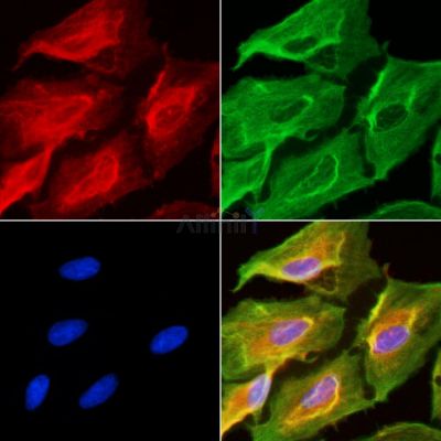 GJC2 Antibody - DF4078 staining A549 cells(UV treatment) by IF/ICC.