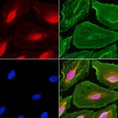 GCF Antibody - DF4083 staining A549 cells(UV treatment) by IF/ICC.