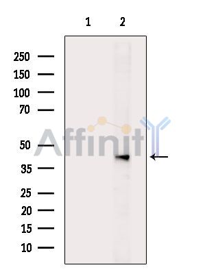 PAX2 Antibody - Western blot analysis of extracts from MCF7 cells(serum starvation treatment), using PAX2 Antibody.